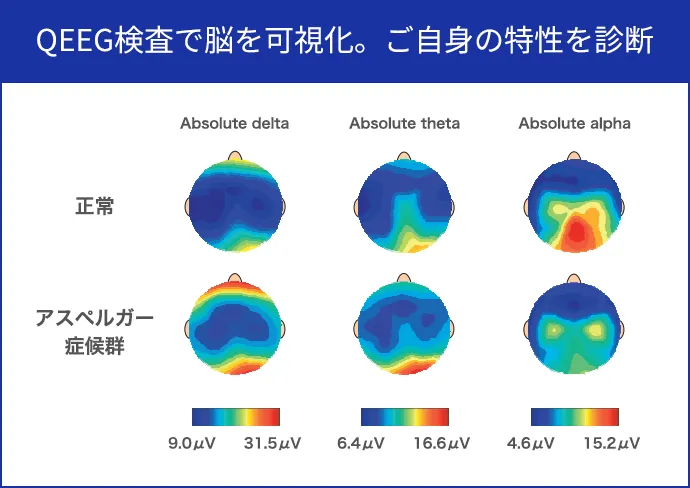 QEEG検査で脳を可視化。ご自身の特性を診断
