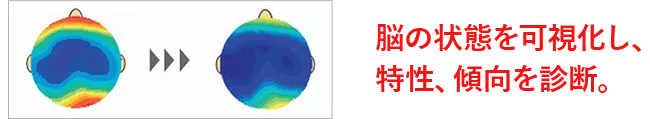 脳の状態を可視化し、特性、傾向を診断。