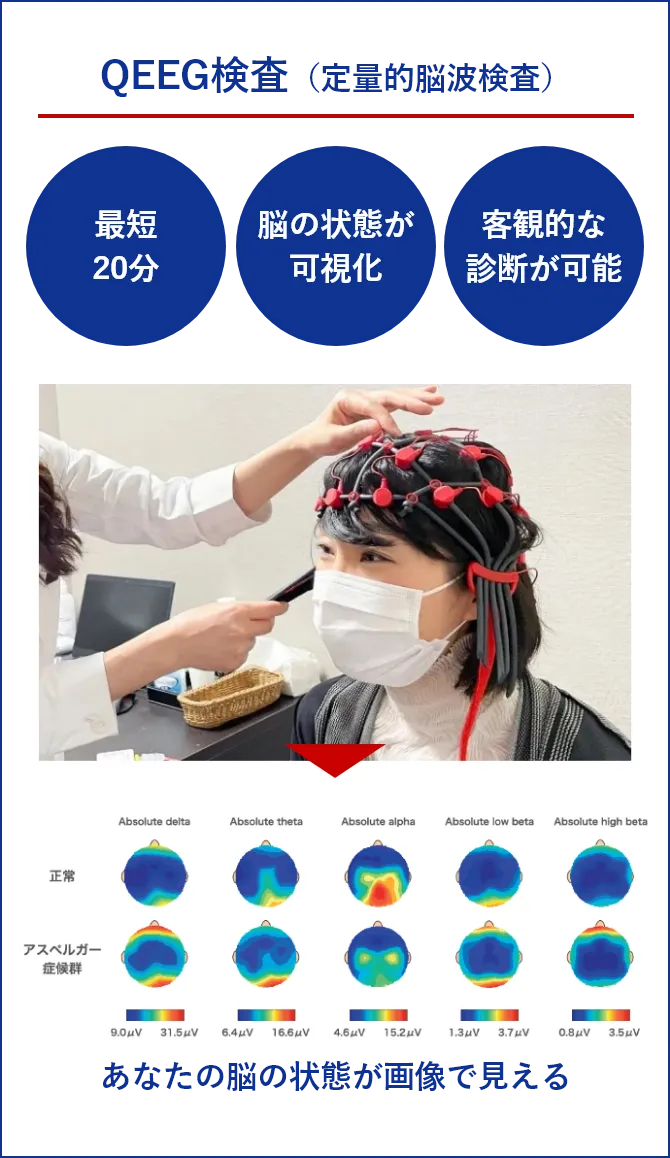 QEEG検査（定量的脳波検査）