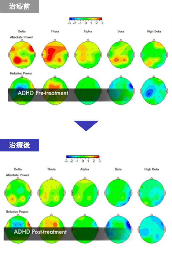 治療前と治療後の比較画像