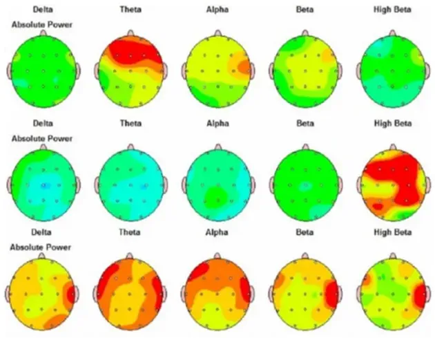 脳波の強弱などから、眠気・集中力・不安などの傾向が読み取れる