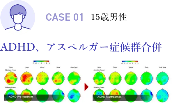 CASE01 15歳男性