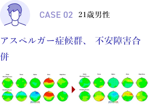CASE02 21歳男性