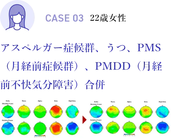 CASE03 22歳女性