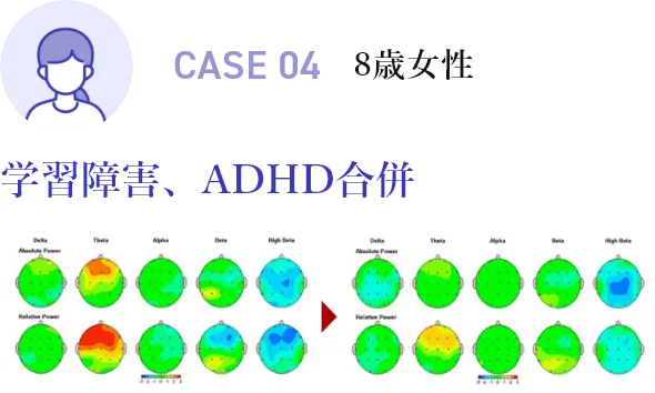 CASE04 8歳女性