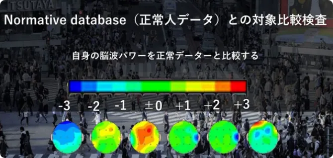 Normative database(正常人データ)との対象比較検査