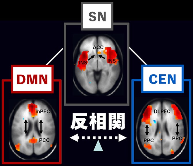 脳の神経ネットワークの相関関係