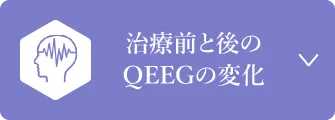 治療前と後のQEEGの変化