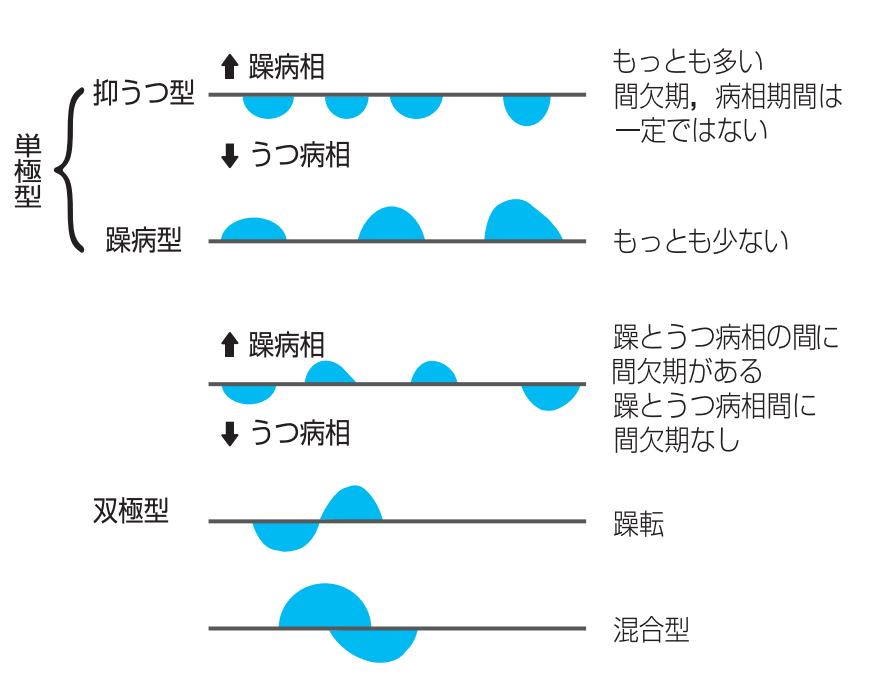 双極性スペクトルとは何ですか?